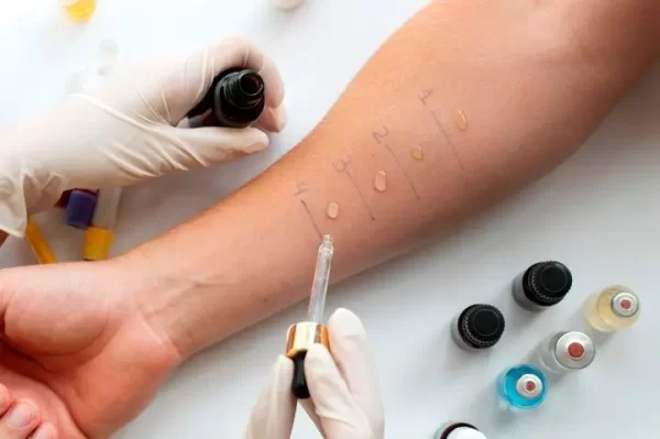 prick test