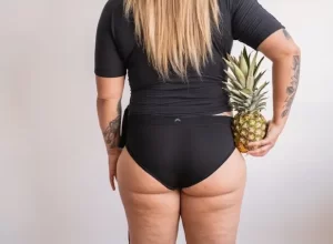 žena s celulitidou