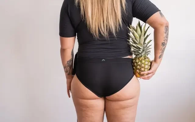žena s celulitidou